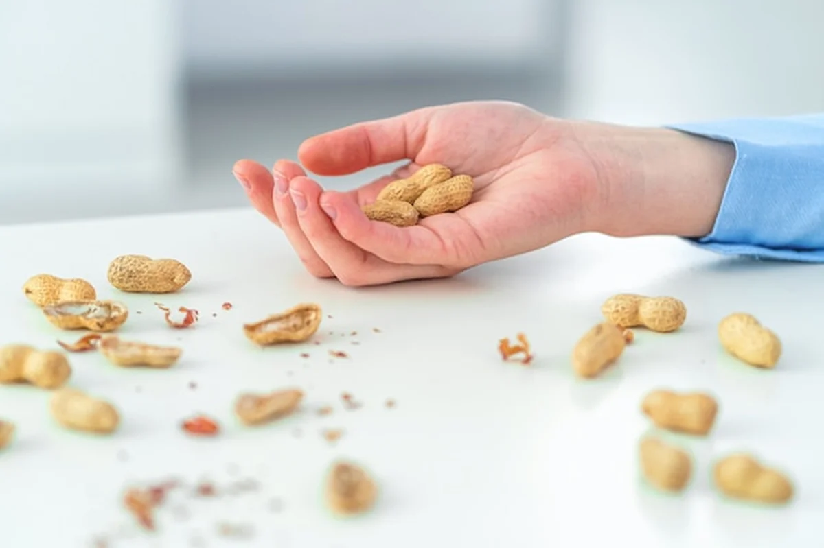 Osoba reagująca alergicznie na orzeszki ziemne